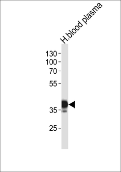 SERPINA7 Antibody (N-term)