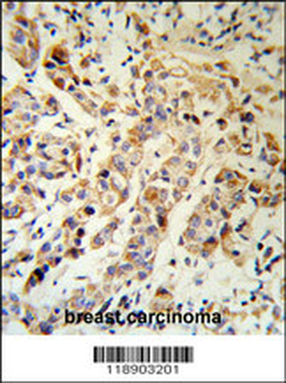 KRT13 Antibody (N-term)
