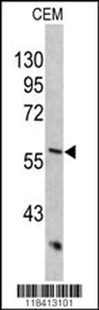 KRT10 Antibody (Center)