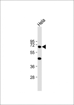 KRT10 Antibody (N-term)