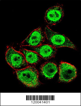 TYSY Antibody (C-term)