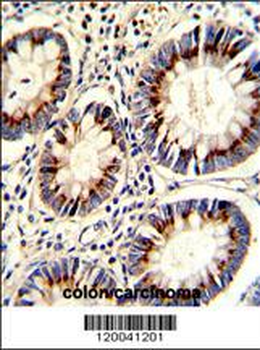 TYSY Antibody (C-term)