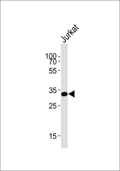 TYSY Antibody (C-term)