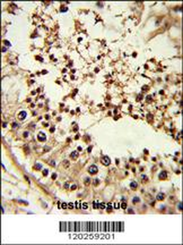 TBP Antibody (Center)