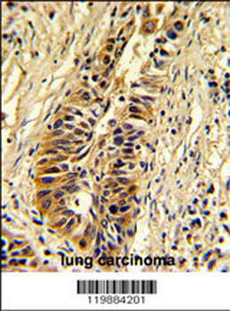 TALDO1 Antibody (Center)