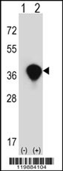 TALDO1 Antibody (Center)