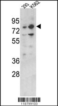 PLZF Antibody (C-term)