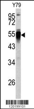 PDIA6 Antibody (Center K159)