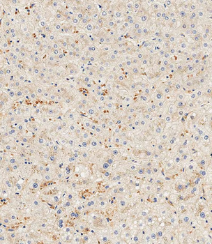 HPX Antibody (Center)