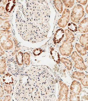 GLS2 Antibody (C-term E513)