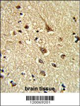 GLO1 Antibody (N-term)