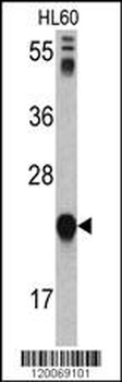 GLO1 Antibody (N-term)