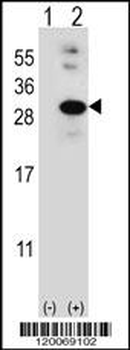 GLO1 Antibody (N-term)