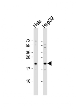 GLO1 Antibody (N-term)