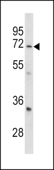 GARP Antibody (Center)