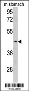 CLUAP1 Antibody (C-term)