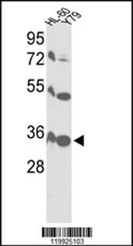VDAC1 Antibody (Center)