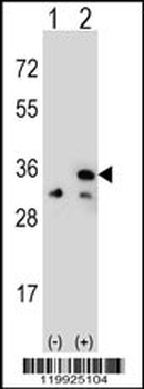 VDAC1 Antibody (Center)