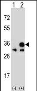VDAC1 Antibody (N-term)