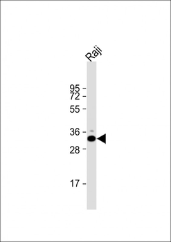 VDAC1 Antibody (N-term)