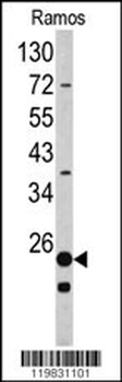 RPS9 Antibody (C-term)
