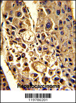 CFHL1 Antibody (C-term)