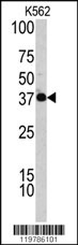 CFHL1 Antibody (C-term)