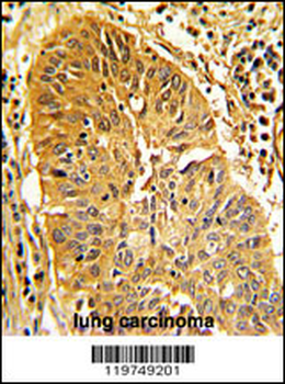 CALD1 Antibody (Center)