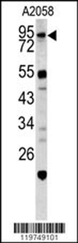 CALD1 Antibody (Center)