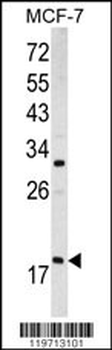 ARF3 Antibody (Center D93)
