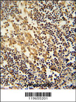 TNFAIP2 Antibody (Center)