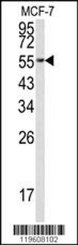 EEF1A1 Antibody (C-term)