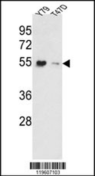 EEF1A1/ EEF1A2 Antibody (N-term)