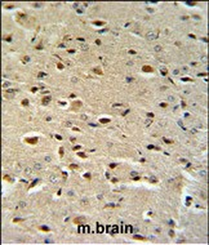 CTNA1 Antibody (N-term)