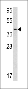 Calponin-3 Antibody (Center)