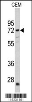 CRAT Antibody (N-term)