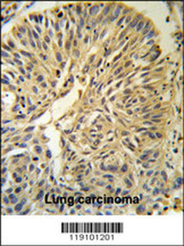 PSA Antibody (Center)