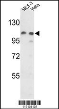 PSA Antibody (Center)
