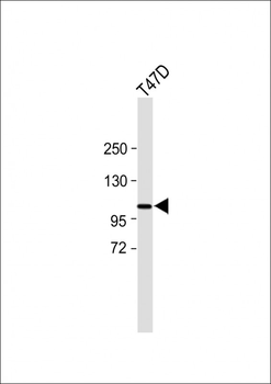 PSA Antibody (Center)