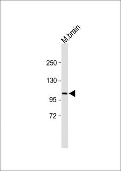 PSA Antibody (Center)