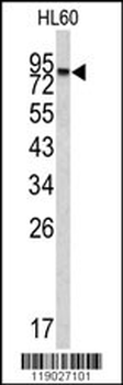 CPXM2 Antibody (N-term)