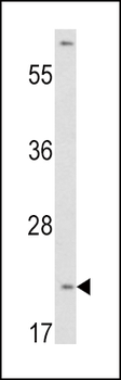 VHL Antibody (N-term)