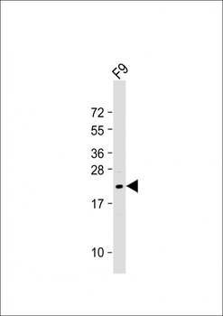 VHL Antibody (N-term)