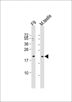 VHL Antibody (N-term)