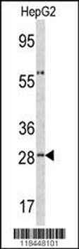 ORM1 Antibody (C-term)