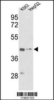 ACTG1 Antibody (Center)