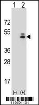 ACTG1 Antibody (Center)
