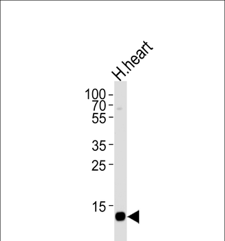 FABP3 Antibody (N-term)