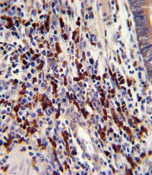 CNOT8 Antibody (C-term)