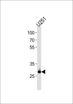 CNOT8 Antibody (C-term)